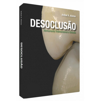 Desoclusão - Alinhamento Tridimensional E Oclusão