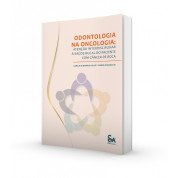 Odontologia Na Oncologia - Atenção Interdisciplinar á Saúde Bucal Do Paciente Com Câncer De Boca