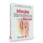 Infecções Odontogênicas E Suas Implicações 