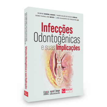 Infecções Odontogênicas E Suas Implicações 