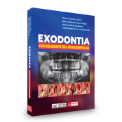 Exodontia - Gerenciamento Das Intercorrências 