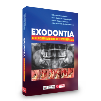 Exodontia - Gerenciamento Das Intercorrências 