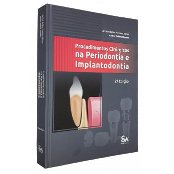 Procedimentos Cirúrgicos Na Periodontia e Implantodontia