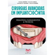 Cirurgias Avançadas Em Implantodontia - Princípios, Fundamentos e Técnicas