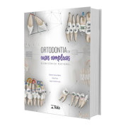 Ortodontia Em Casos Complexos - Biomecânica Racional 
