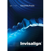 Invisalign - Excelência Com Biomecânica Simples