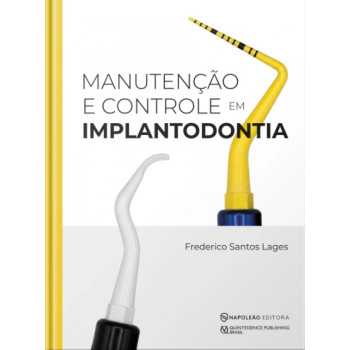 Manutenção E Controle Em Implantodontia Manutenção E Controle Em Implantodontia