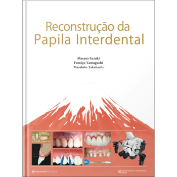 Reconstrução Da Papila Interdental Reconstrução Da Papila Interdental