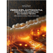 Perio-Implantodontia Frente Aos Desafios Do Nosso Tempo