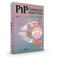 PIP - Procedimentos em Implante e Prótese
