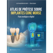 Atlas De Prótese Sobre Implantes Cone Morse - Fluxo Analógico E Digital