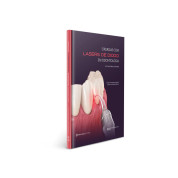 Cirurgias Com Lasers De Diodo Em Odontologia - Um Guia Prático E Ilustrado