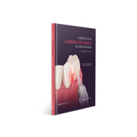 Cirurgias Com Lasers De Diodo Em Odontologia - Um Guia Prático E Ilustrado