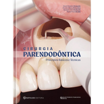 Cirurgia Parendodôntica - Princípios Básicos E Técnicas