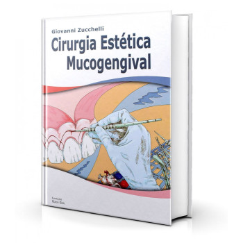 Cirurgia Estética Mucogengival 