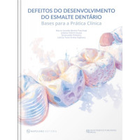 Defeitos Do Desenvolvimento Do Esmalte Dentário - Bases Para A Prática Clínica
