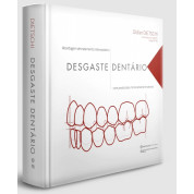 Desgaste Dentário - Abordagem De Tratamento Interceptativo Com Protocolos Minimamente Invasivos 