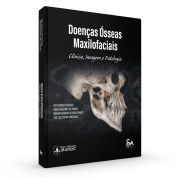 Doenças Òsseas Maxilofaciais Clínica Imagem E Patologia