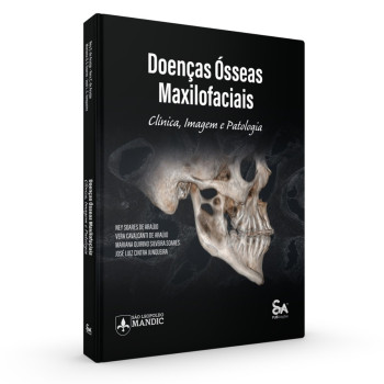 Doenças Òsseas Maxilofaciais Clínica Imagem E Patologia