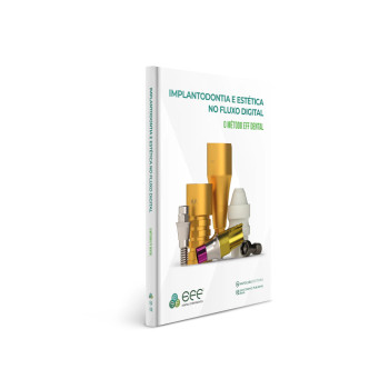 Implantodontia E Estética No Fluxo Digital - O Método EFF Dental Implantodontia E Estética No Fluxo Digital - O Método EFF Dental