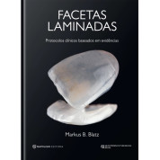 Facetas Laminadas - Protocolos Clínicos Baseados Em Evidências