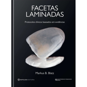 Facetas Laminadas - Protocolos Clínicos Baseados Em Evidências