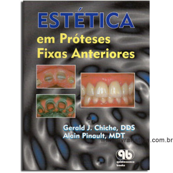 Estética em Prótese Fixa Anteriores - 1a/96