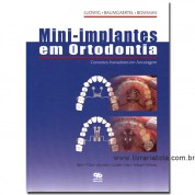Mini-Implantes em Ortodontia 