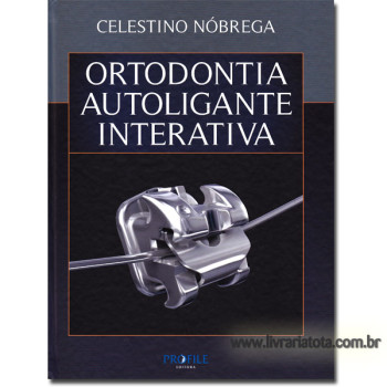 Ortodontia Autoligante Interativa