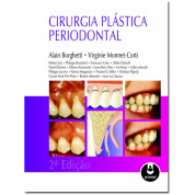 CIRURGIA PLASTICA PERIODONTAL