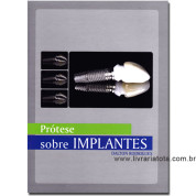 Prótese sobre Implantes: Passos Clínicos e Laboratoriais