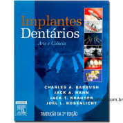 Implantes Dentários: Arte e Ciência