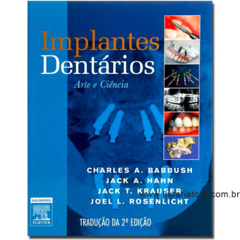 Implantes Dentários: Arte e Ciência