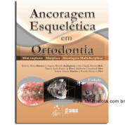 Ancoragem Esquelética em Ortodontia 
