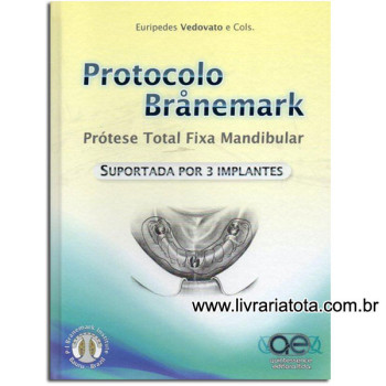 Protocolo de Branemark – Prótese Total Fixa Mandibular Suportada por 3 Implantes