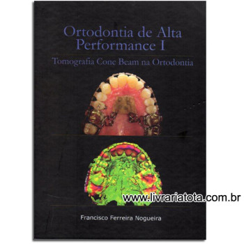 Ortodontia de Alta Performance I - Tomografia Cone Bean na Ortodontia 