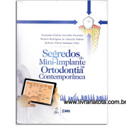 Segredos do Mini-implante na Ortodontia Contemporânea