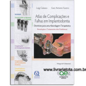 Atlas de Complicações e Falhas em Implantodontia
