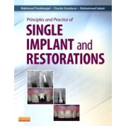 PRINCIPLES AND PRACTICE OF SINGLE IMPLANT AND RESTORATION