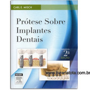 Próteses sobre Implantes Dentais