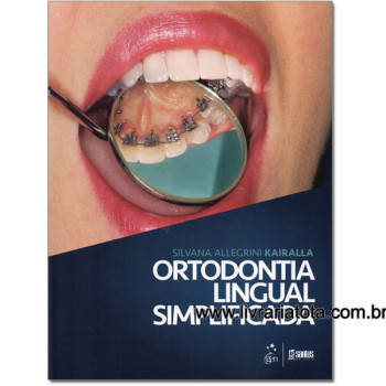 Ortodontia Lingual Simplificada