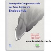 Tomografia Computadorizada por Feixe Cônico em Endodontia
