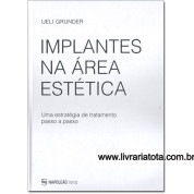 Implantes Na Área Estética – Uma estratégia de tratamento passo-a-passo