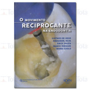 O Movimento Reciprocante na ENDODONTIA