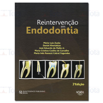 Reintervenção em Endodontia