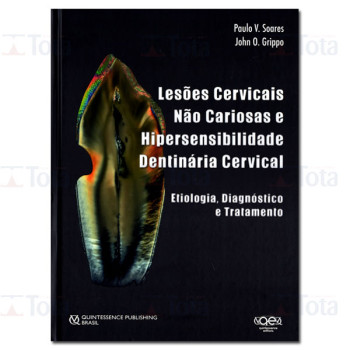 Lesões Cervicais não Cariosas e Hipersensibilidade Dentinária Cervical: Etiologia, Diagnóstico e Tratamento