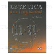 Estética em Implantes 11.21