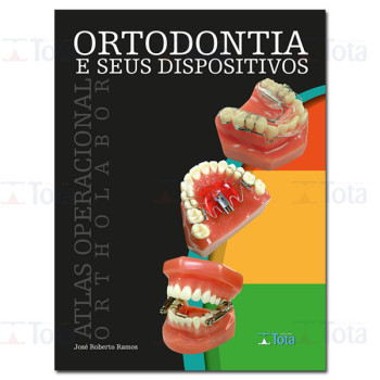 Ortodontia e seus Dispositivos - Atlas Operacional Ortholabor