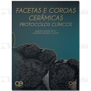 Facetas e Coroas Cerâmicas – Protocolos Clínicos