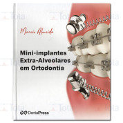 Mini-implantes Extra-Alveolares em Ortodontia